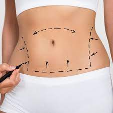 Liposuction in Dubai: The Ultimate Solution for Your Body Contouring Goals
